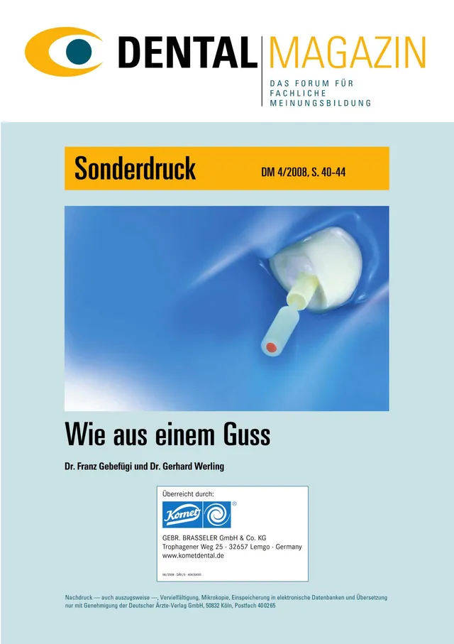 komet-dental-shax-wie-aus-einem-guss-fachbericht-wurzelkanalstifte image 1