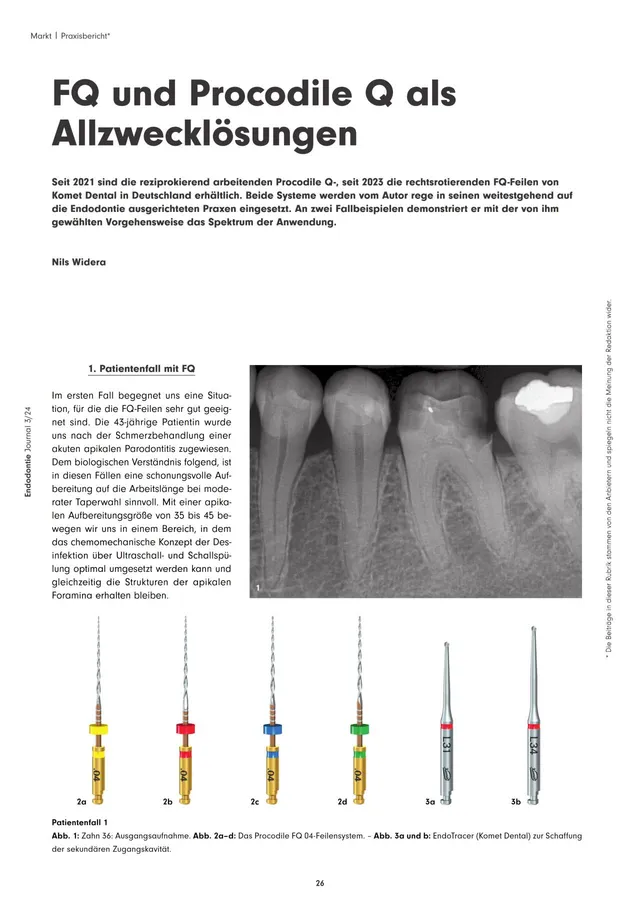 komet-dental-procodile-q-fachbericht-allzweckl-sungen-ej-03-2024 image 1