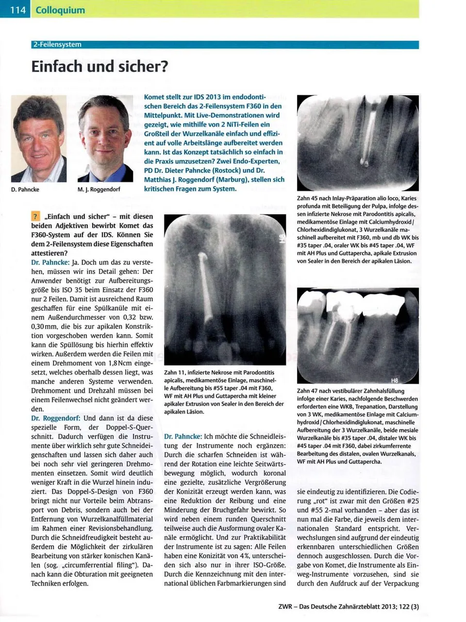 komet-f360-fachbericht-2-feilensystem-endo image 1