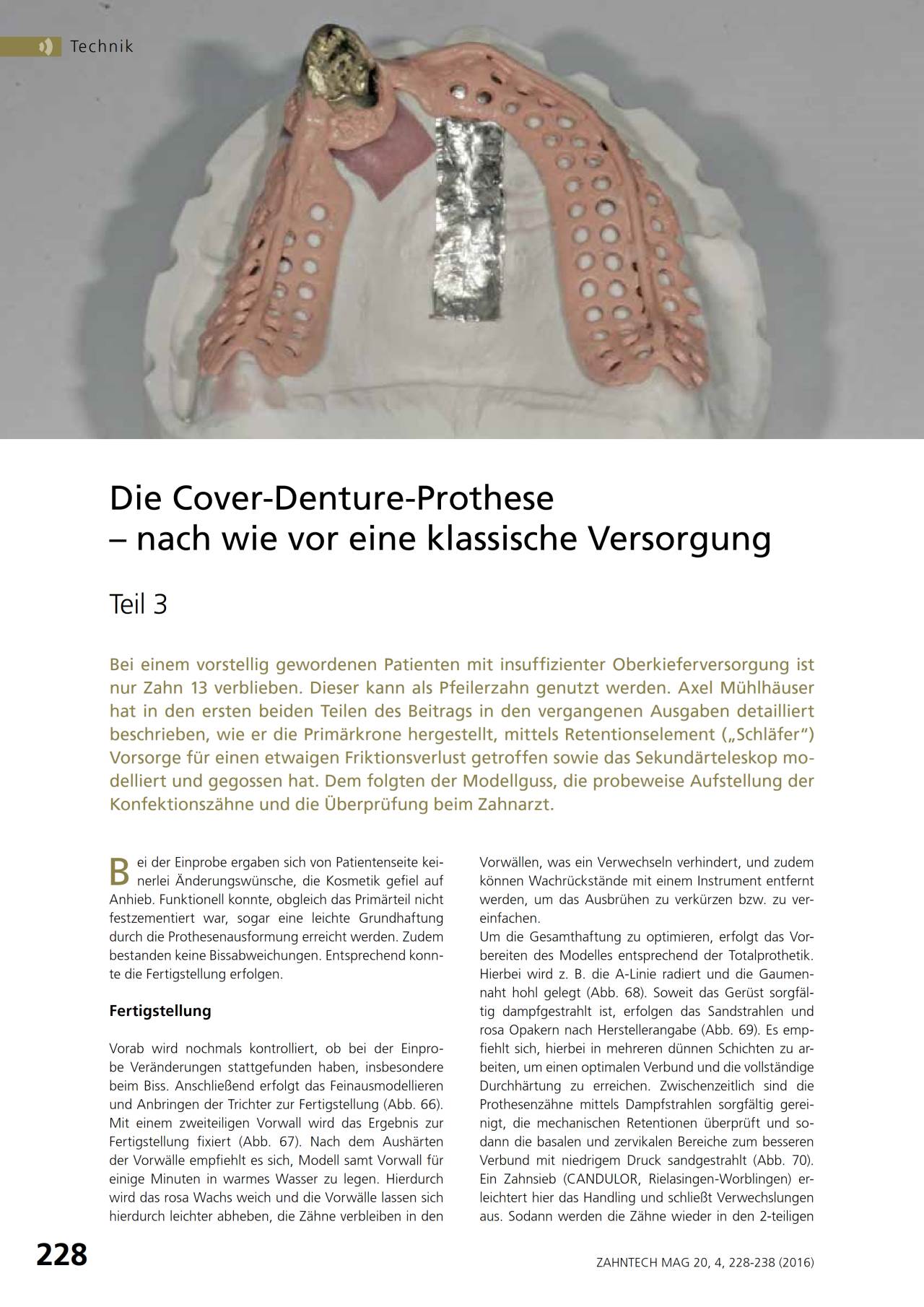 komet-shax-fachbericht-cover-denture-prothese-teil-3-m-hlhaeuser image 1