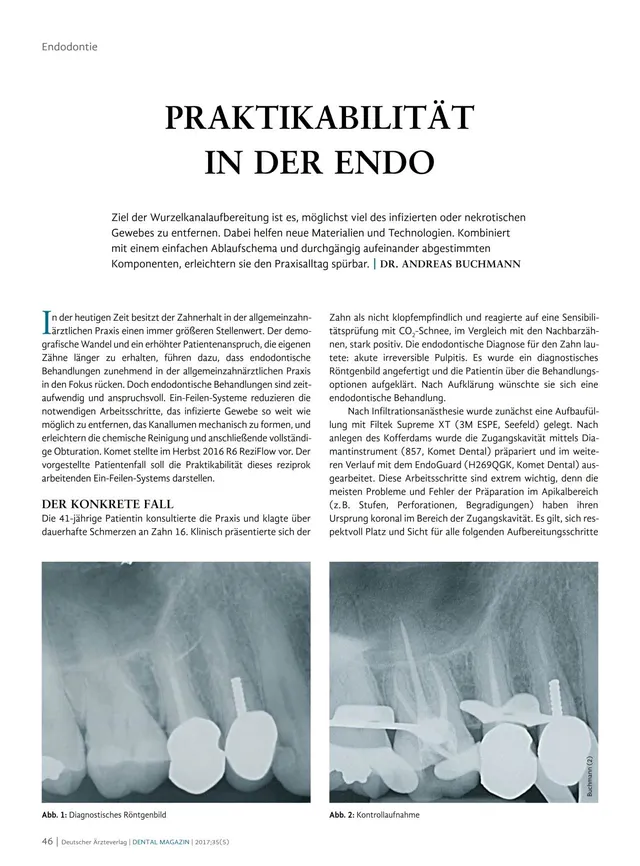 komet-dental-fq-fachbericht-endo-wurzelkanal-06-2017 image 1