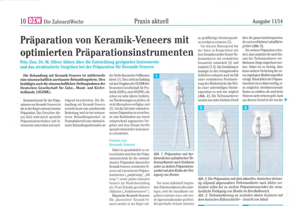 komet-ceracut-fachbericht-keramik-veneers-pr-paration image 1