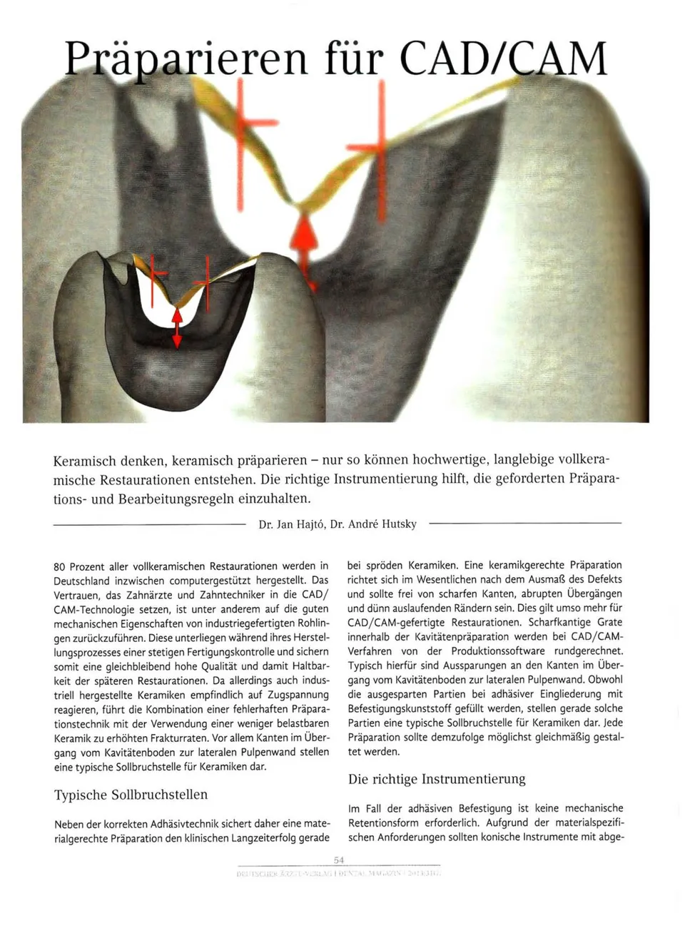 komet-diao-pr-parieren-cad-cam-fachbericht-keramik image 1