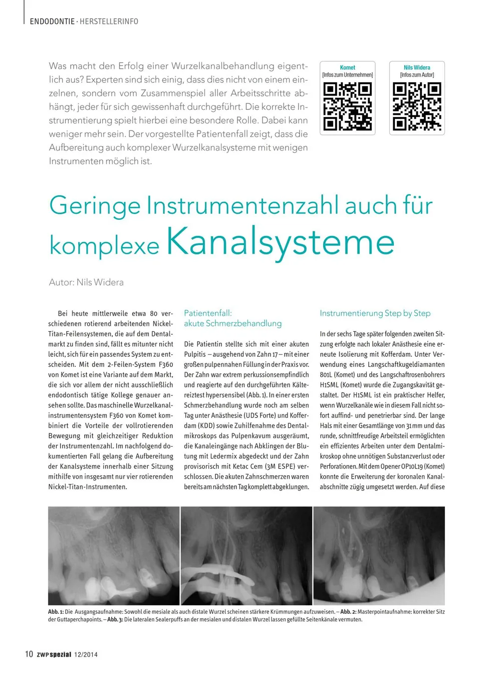 komet-f360-patientenfall-endo-feilen-nils-widera-pdf image 1