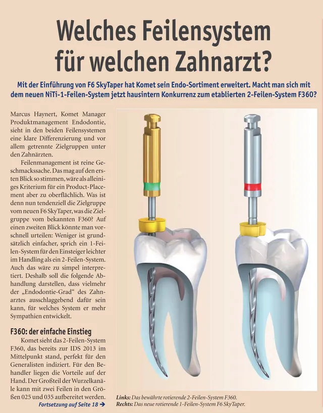 komet-dental-fq-f6-skytaper-feilen-fachbericht-niti image 1