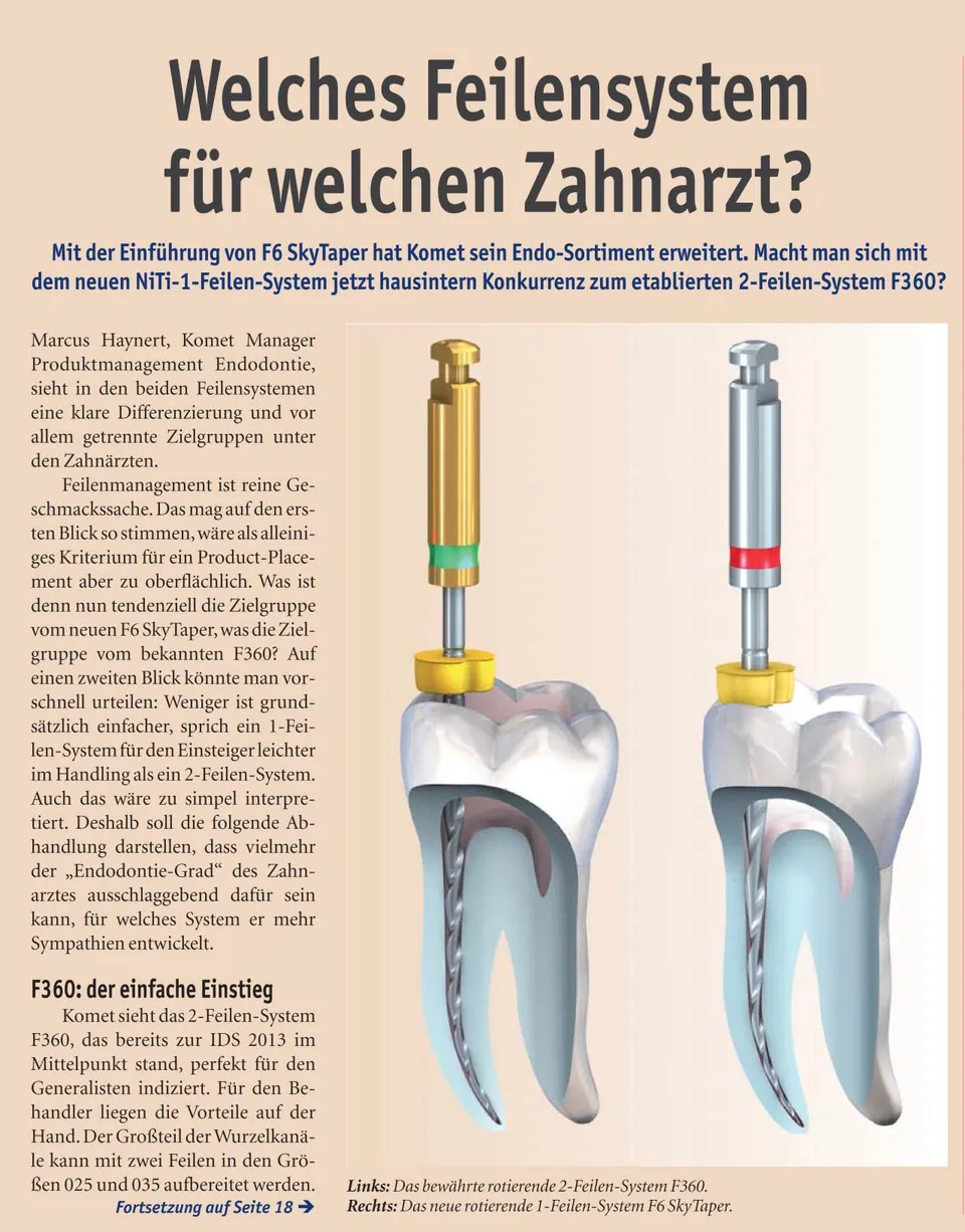 komet-dental-fq-f6-skytaper-feilen-fachbericht-niti image 1