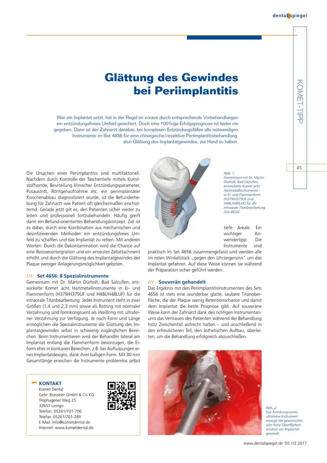 komet-dental-diao-komet-tipp-periimplantitis-2017-02 image 1