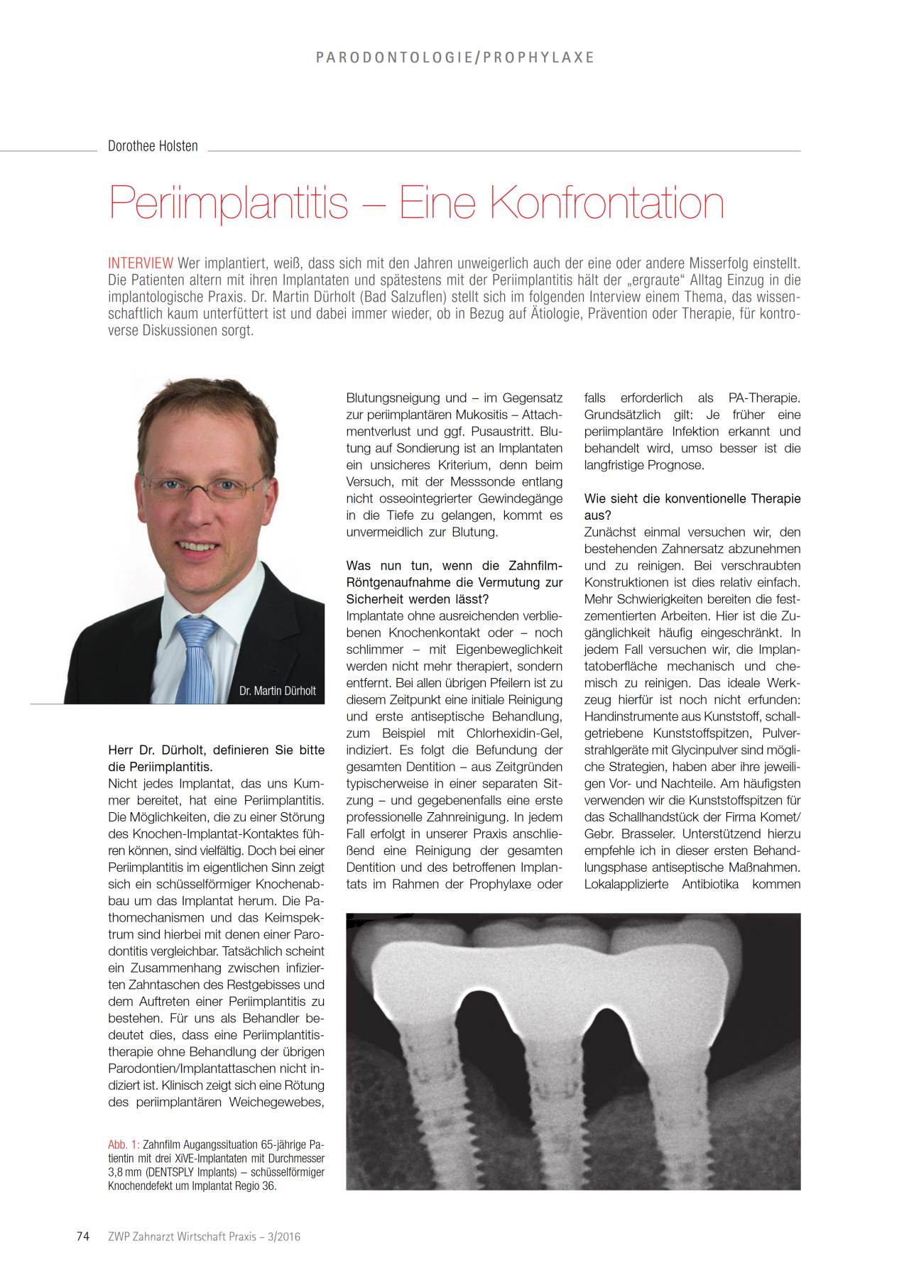 komet-dental-ceradrill-periimplantitis-fachbericht-implantat image 1