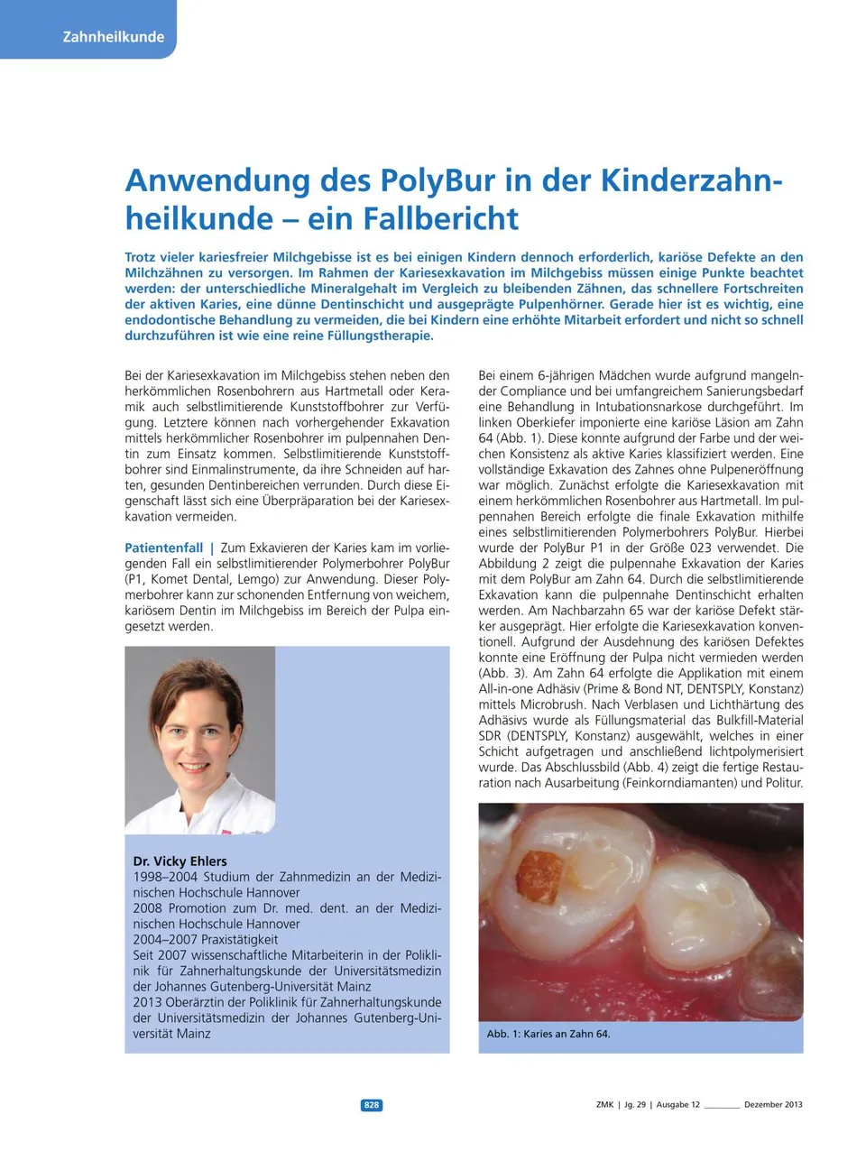 komet-polybur-fallbericht-kinderzahnheilkunde-zmk-12-2013 image 1