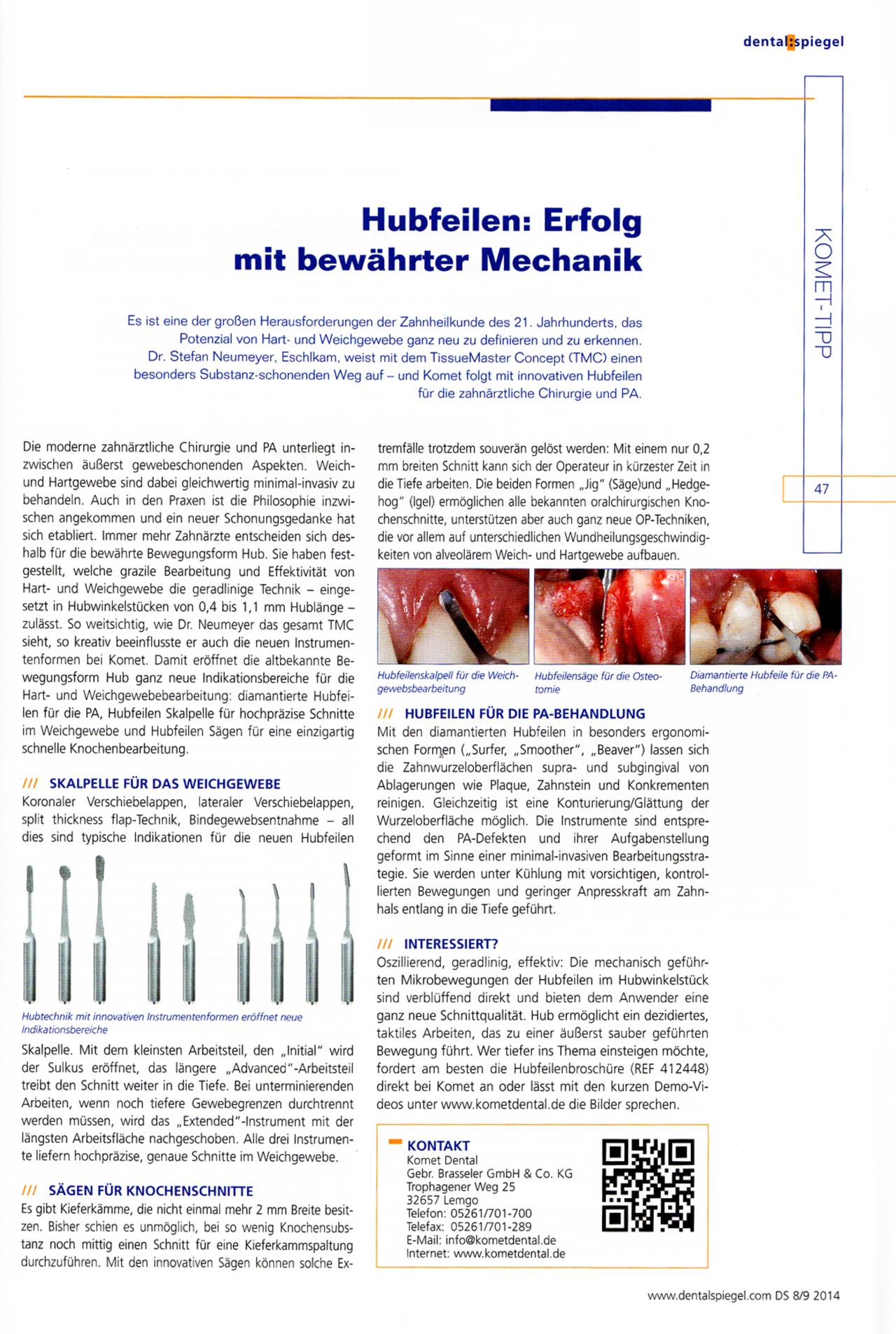 komet-diao-tipp-2014-08-hubfeilen-mechanik-pdf image 1