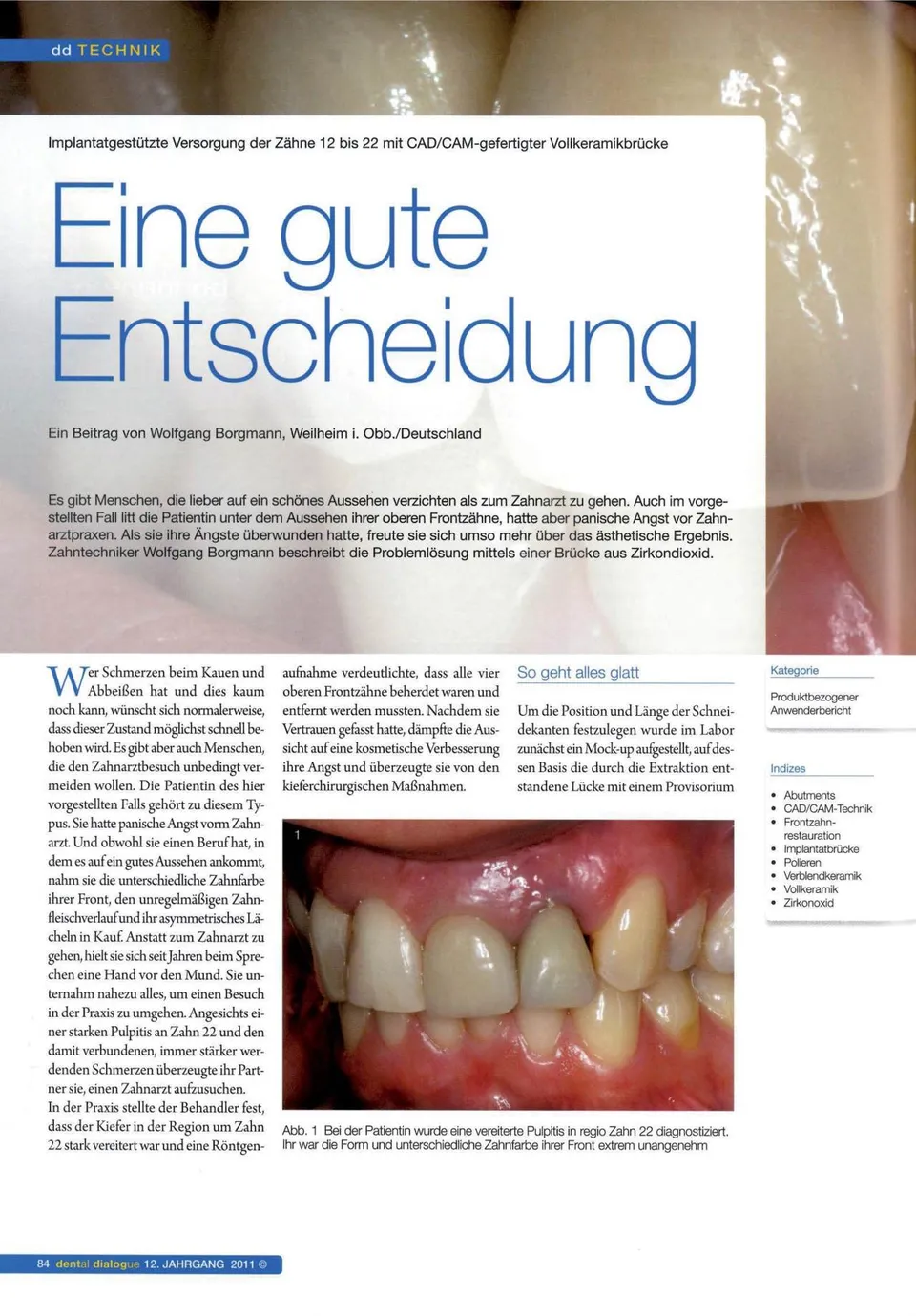 komet-dental-art2-keramikpolierer-fachbericht-vollkeramik image 1