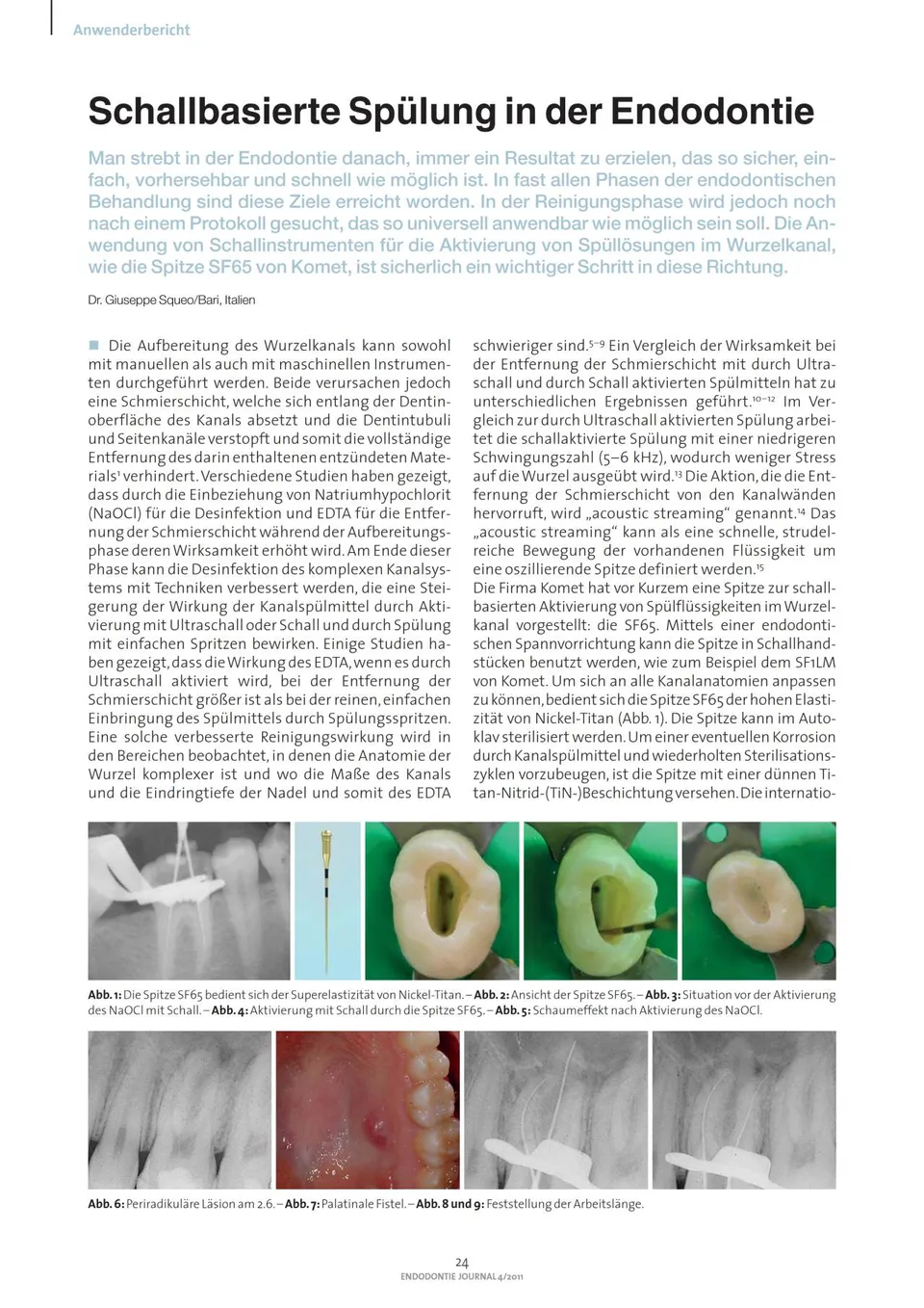 komet-sonicline-fachbericht-schallsp-lung-endodontie-sf65 image 1