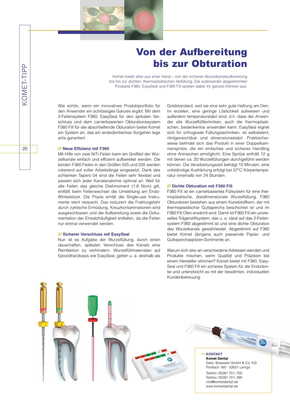 komet-dental-diao-2013-01-komet-tipp-f360-easyseal-endodontie image 1