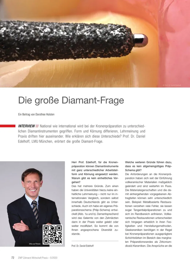 komet-dental-diao-fachbericht-diamant-frage-edelhoff image 1