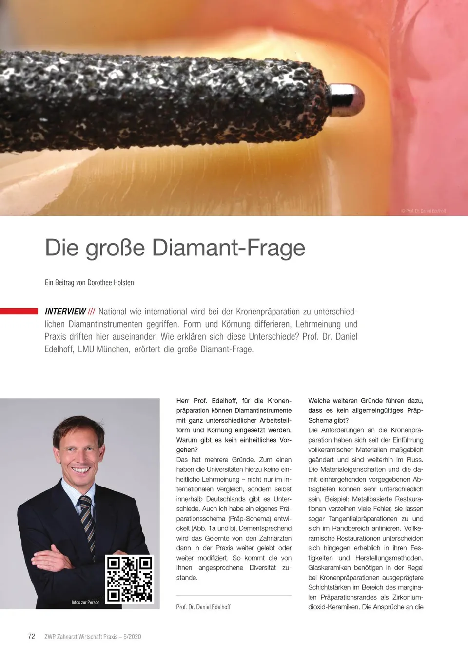 komet-dental-diao-fachbericht-diamant-frage-edelhoff image 1