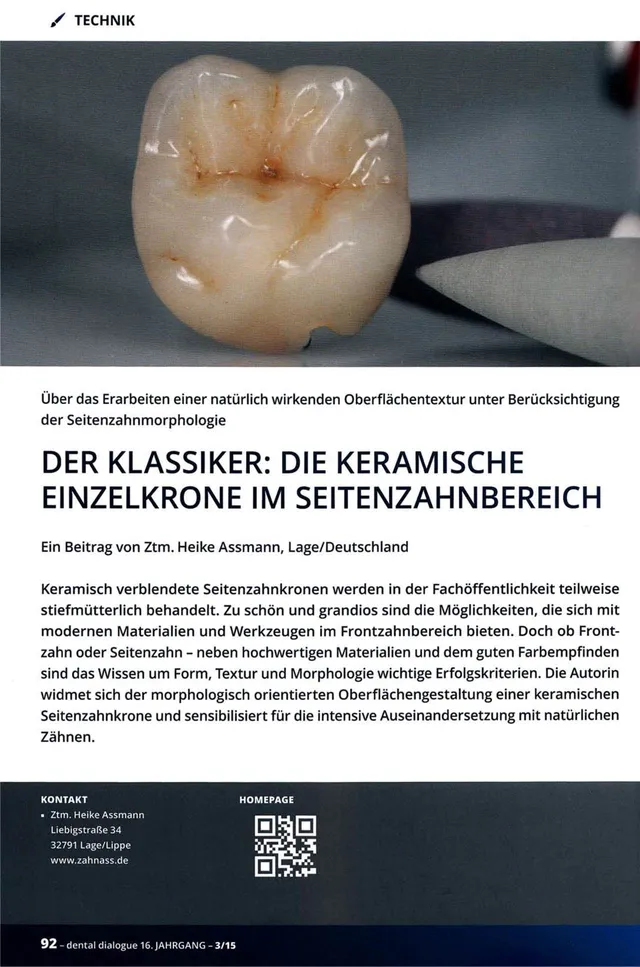 komet-diao-fachbericht-einzelkrone-keramik-seitenzahn-04-2015 image 1