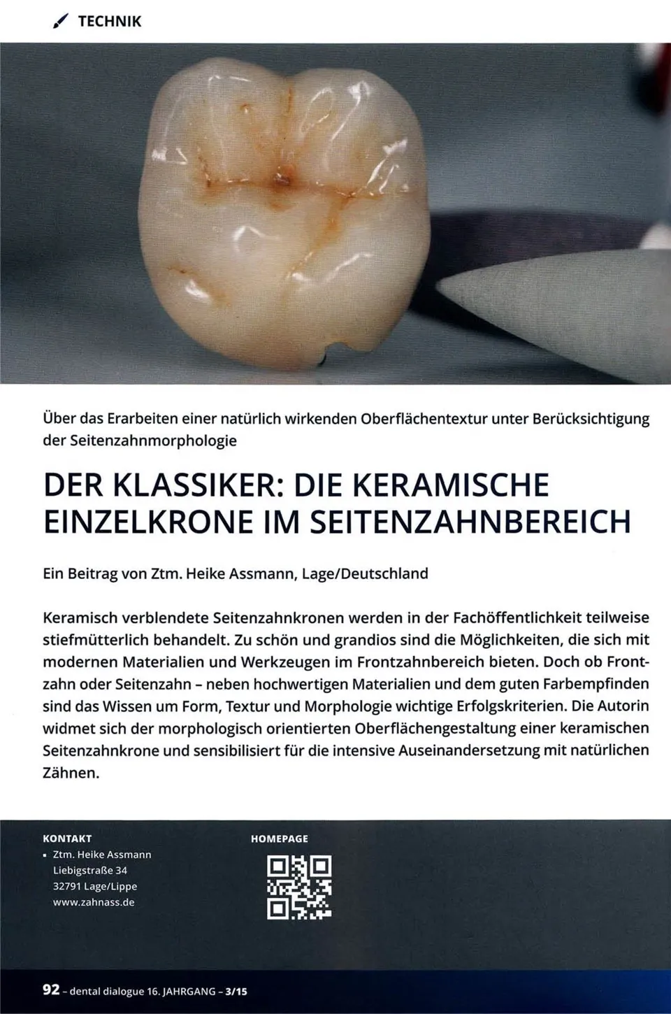komet-diao-fachbericht-einzelkrone-keramik-seitenzahn-04-2015 image 1