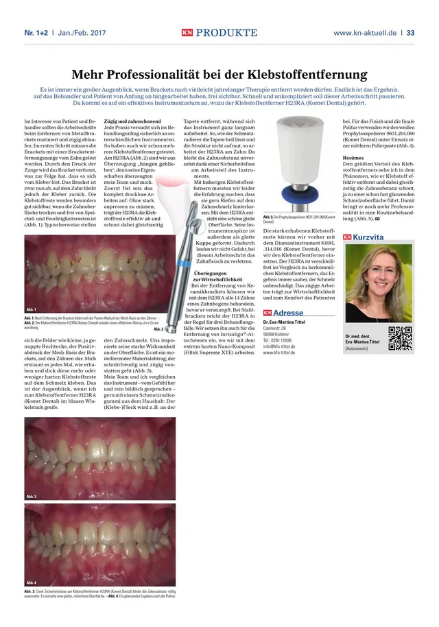 komet-dental-diao-fachbericht-klebstoffentfernung-kfo image 1