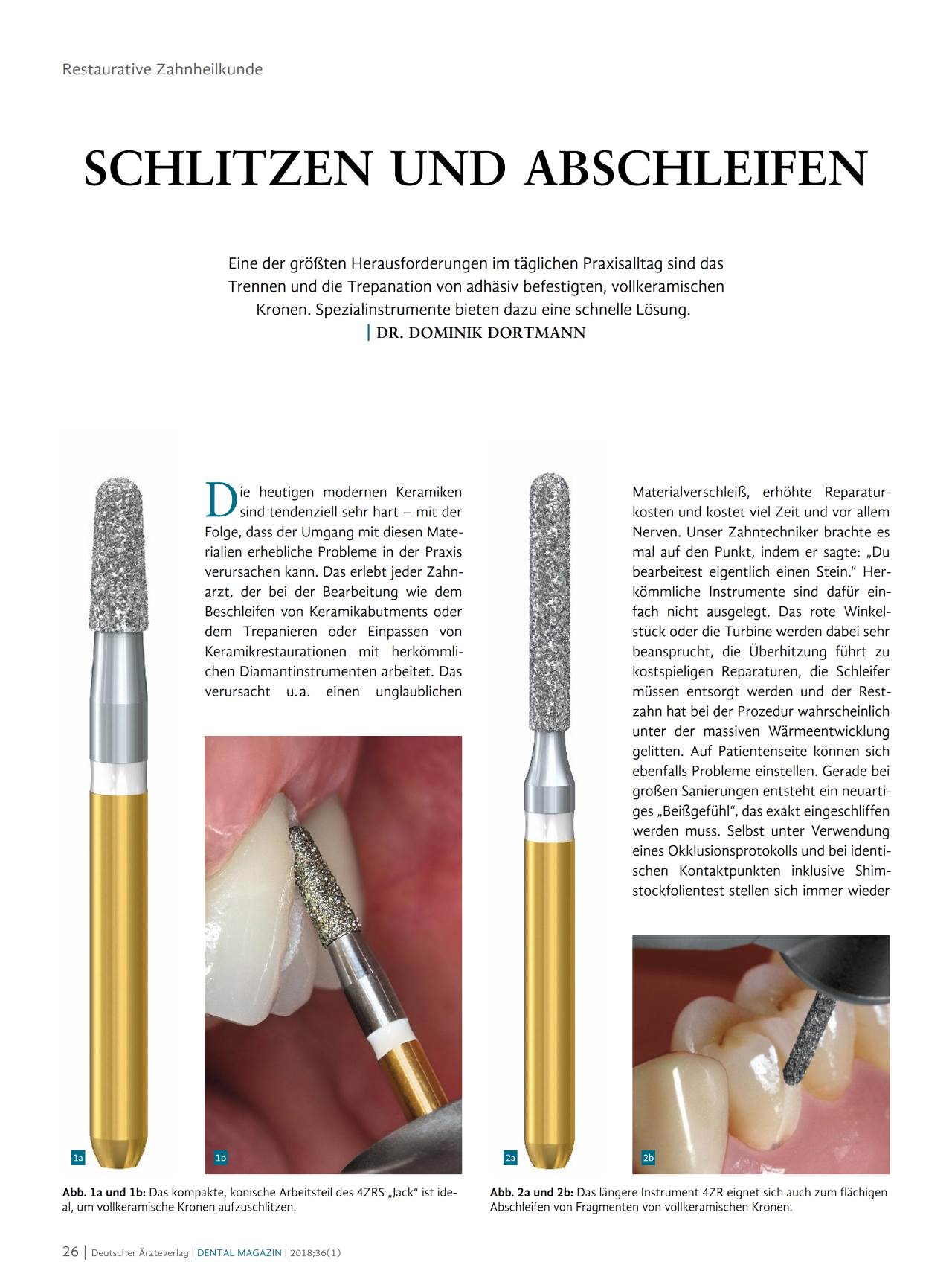 komet-diao-fb-fachbericht-schlitzen-abschleifen-vollkeramik image 1