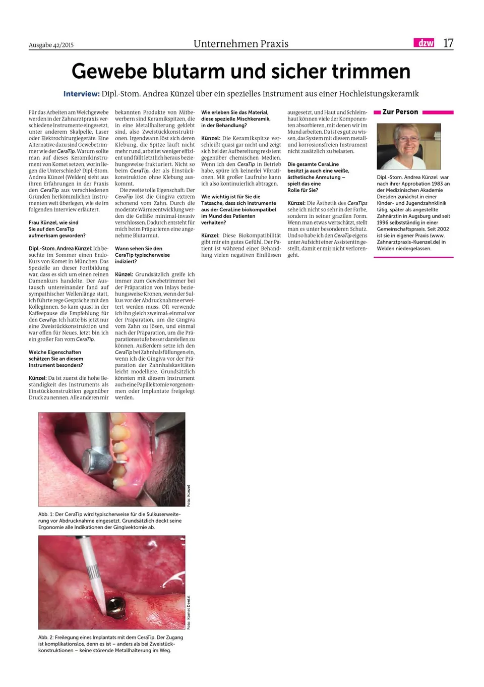 komet-diao-ceratip-fachbericht-gewebetrimmer-keramik image 1