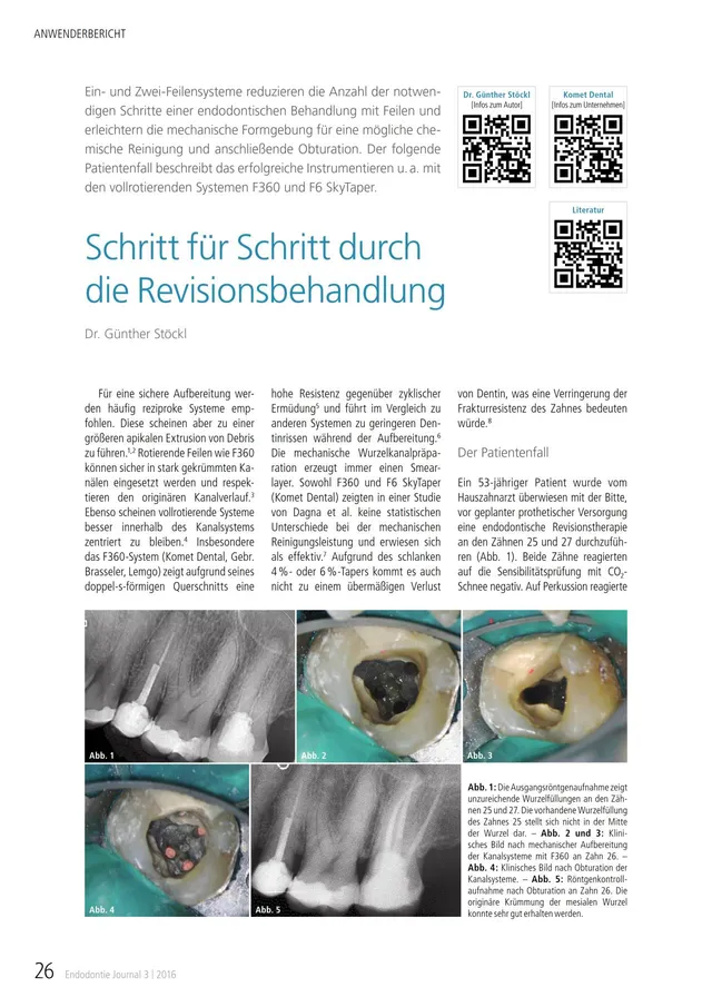 komet-dental-fq-f360-f6-skytaper-revision-fachbericht image 1