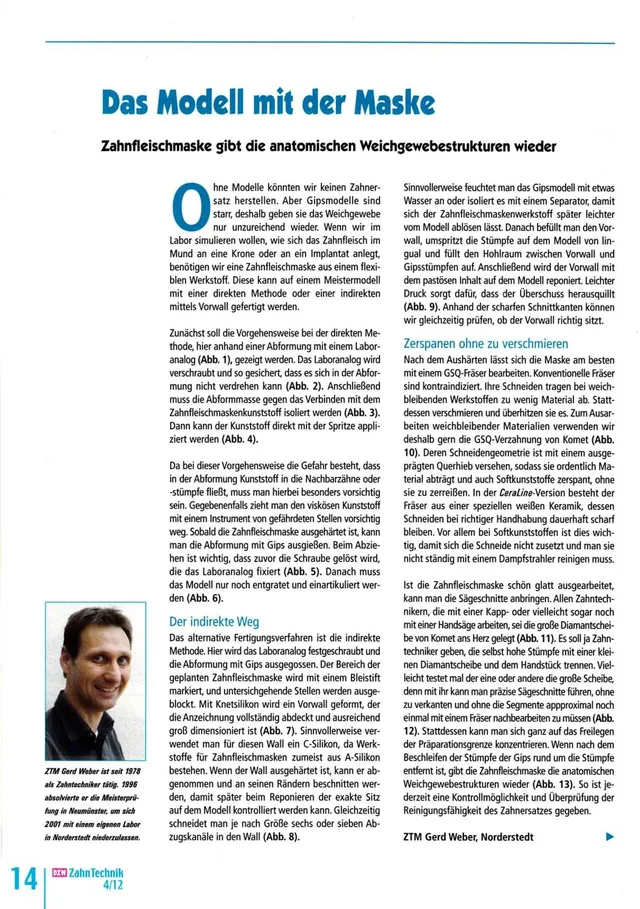 komet-dental-shax-fachbericht-modell-zahnfleischmaske image 1