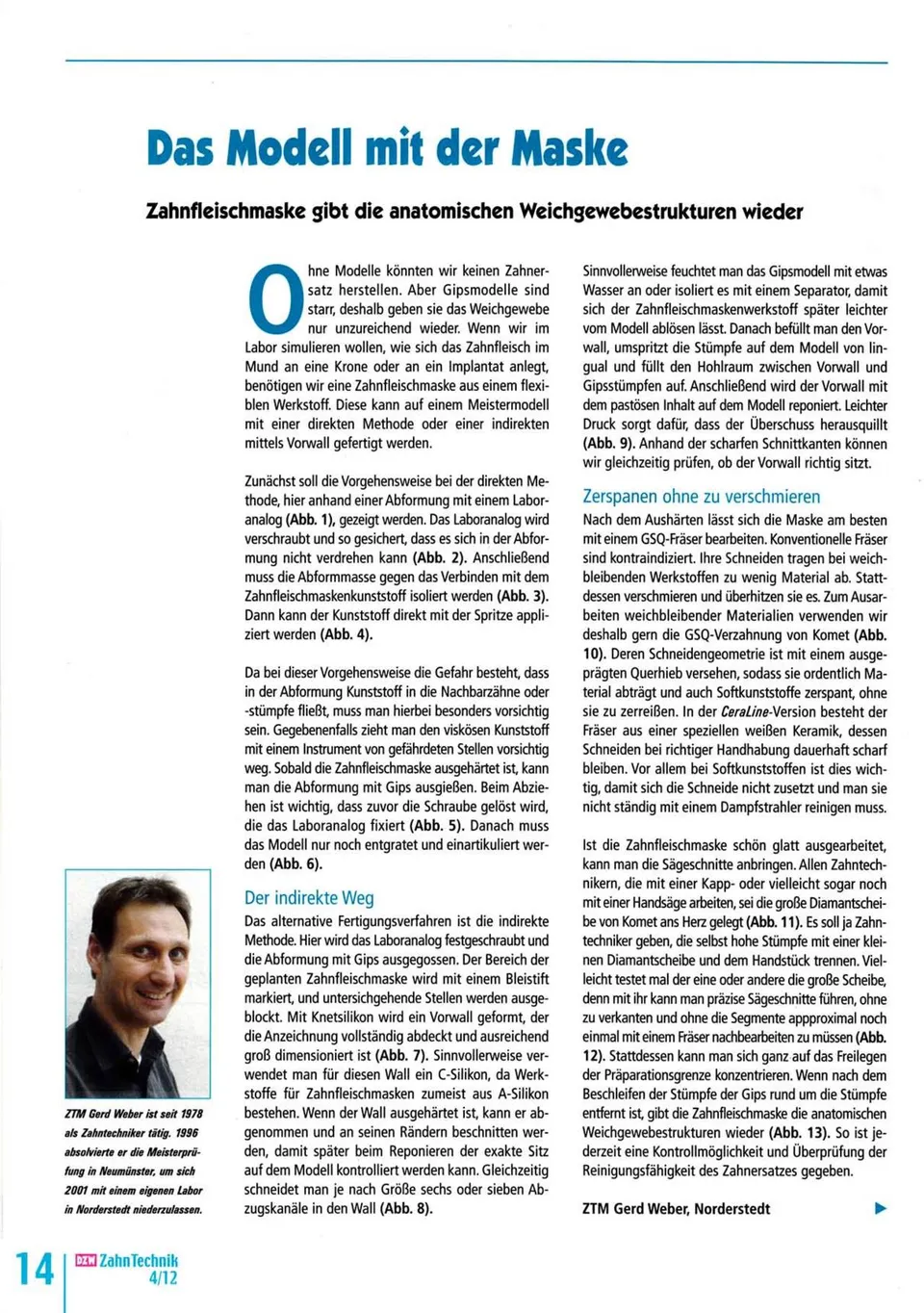 komet-dental-shax-fachbericht-modell-zahnfleischmaske image 1