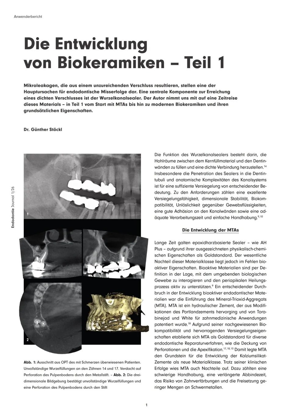 komet-dental-bioseal-fb-biokeramiken-teil-1-fachbericht image 1