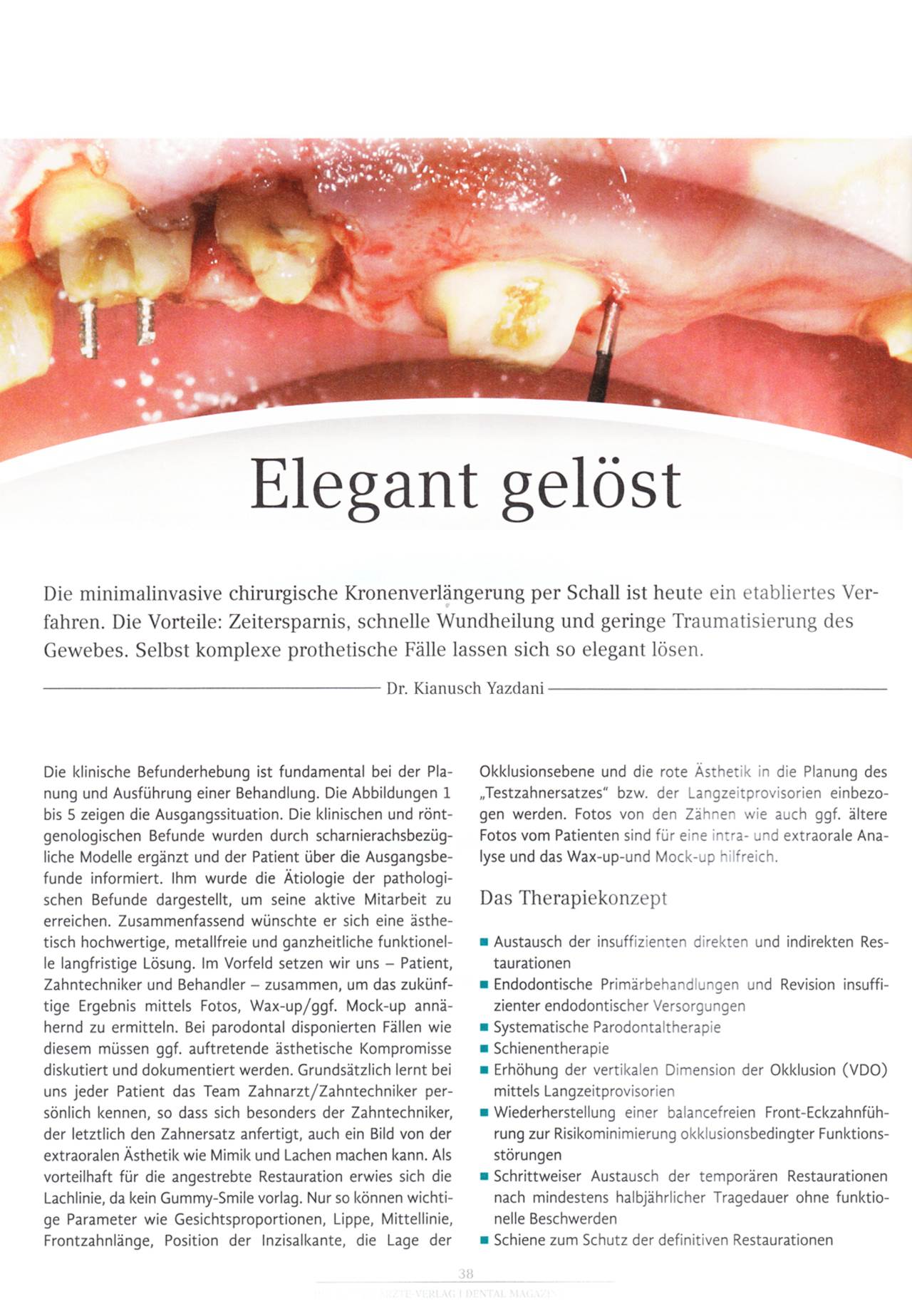 komet-diao-fachbericht-elegant-gel-st-kronenverl-ngerung image 1