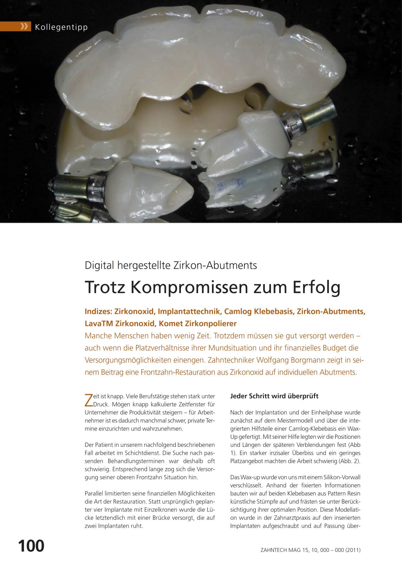 komet-ceracut-zirkonoxid-fachbericht-zirkon-abutments image 1