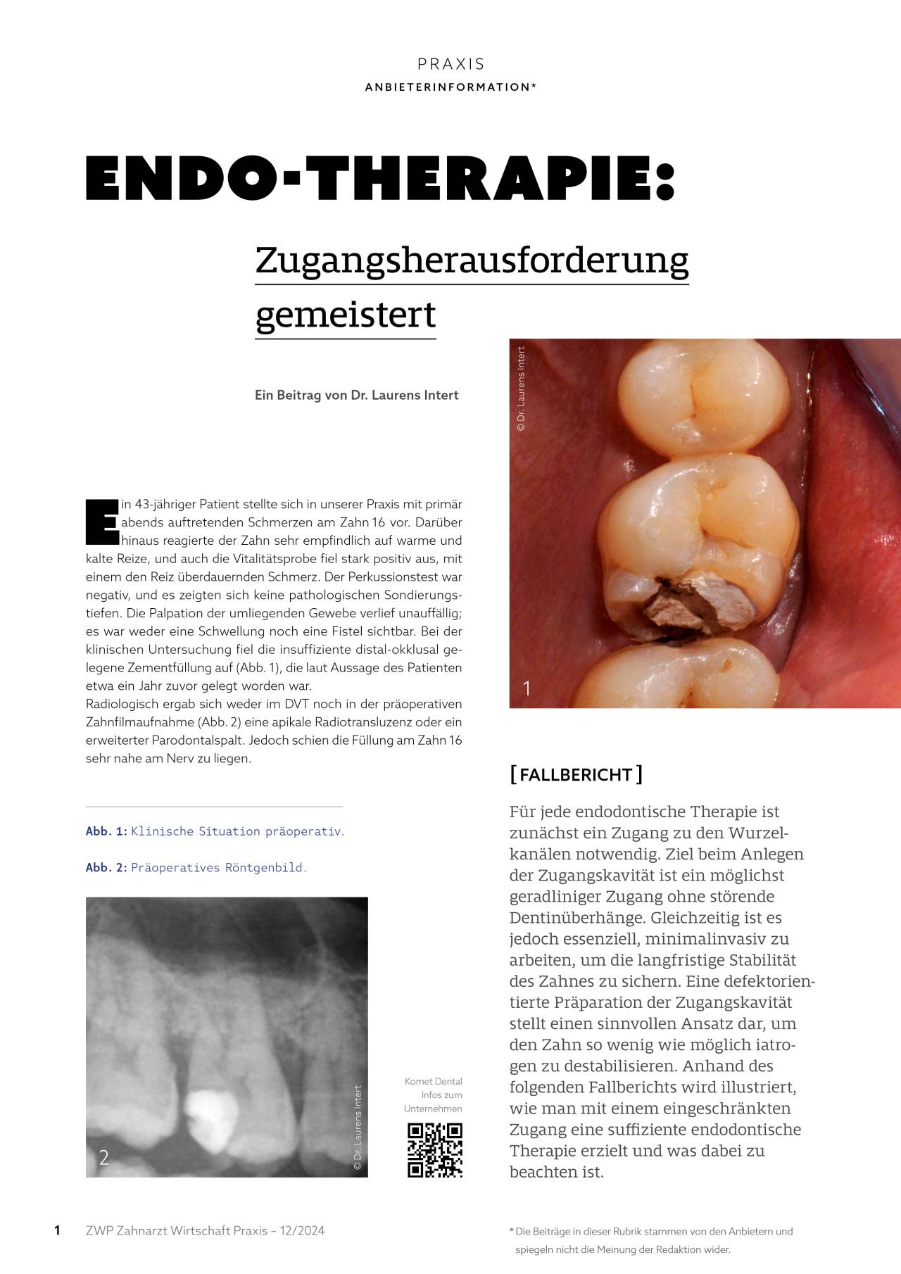 komet-diao-fachbericht-endo-therapie-zugang-zwp-12-2024 image 1