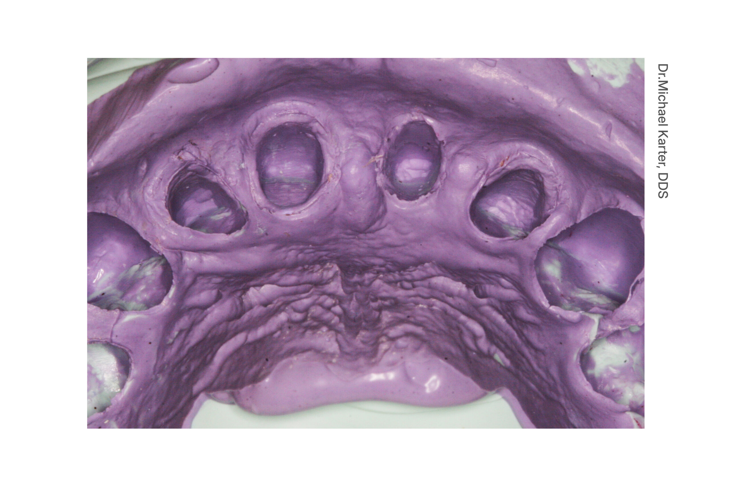 parkell-cinch-90-super-kartusche-abformmaterial-380ml-mittelviskos image 3
