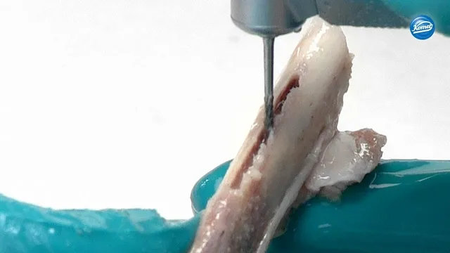 komet-dental-ceradrill-h255e-knochenfr-se-video-zylinder image 1